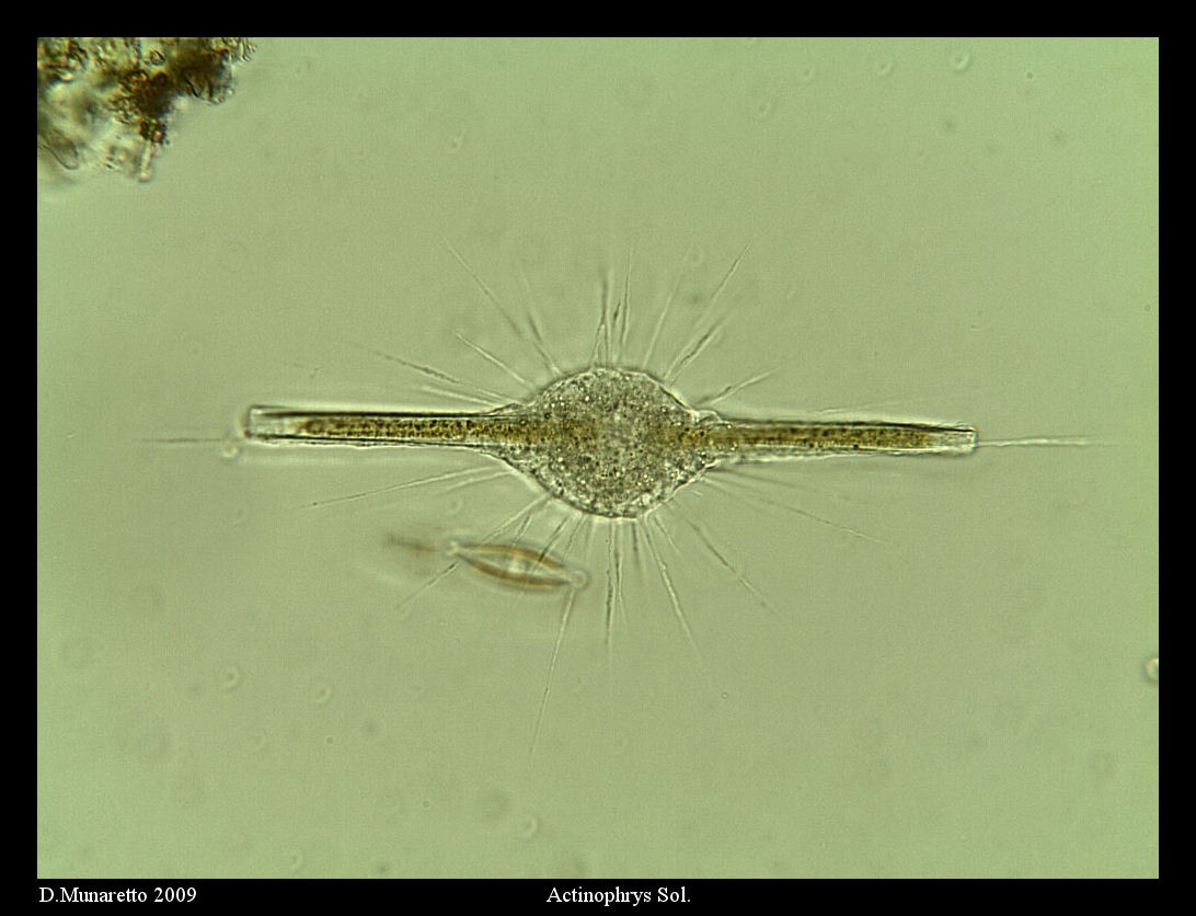 Actinophrys VS Diatomea...